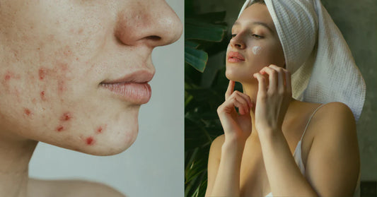 6 Signs That Your Skincare Routine Is Working for You